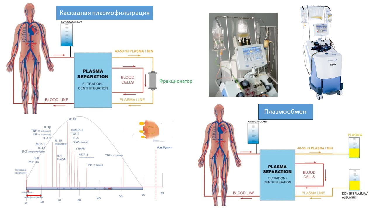 плазмообмен и каскадная плазмофильтрация